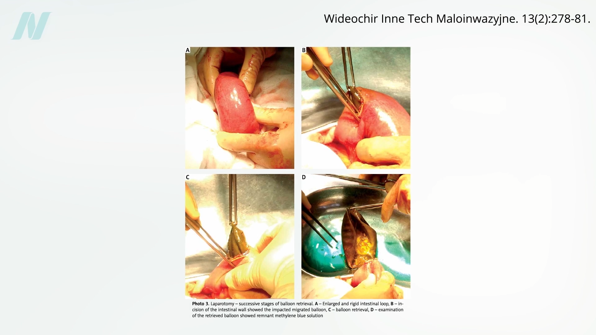 From Gastric Balloons to Fake Knee Surgeries: When the Fix Is an Illusion